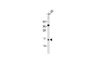 ATP5J2 Antikörper