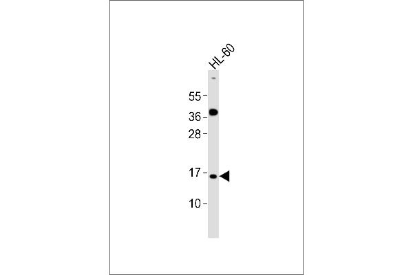 ATP5J2 Antikörper