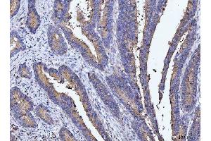 IHC analysis of DEP1/PTPRJ using anti-DEP1/PTPRJ antibody (ABIN7600061).