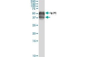 Immunoprecipitation of BCAT2 transfected lysate using rabbit polyclonal anti-BCAT2 and Protein A Magnetic Bead