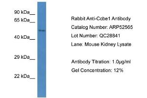 Western Blotting (WB) image for anti-Collagen and Calcium Binding EGF Domains 1 (CCBE1) (C-Term) antibody (ABIN2784990) (CCBE1 Antikörper  (C-Term))