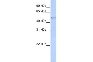 WB Suggested Anti-IRF4 Antibody Titration:  0. (IRF4 Antikörper  (Middle Region))
