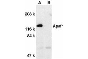 Western blot analysis of Apaf1 in human heart tissue lysate with Apaf1 (CT) antibody at 1μg/ml in the absence (A) or presence (B) of blocking peptide. (APAF1 Antikörper  (C-Term))