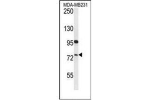 Western blot analysis of HFM1 Antibody (C-term) in MDA-MB231 cell line lysates (35ug/lane). (HFM1 Antikörper  (C-Term))