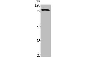 Western Blot analysis of Jurkat cells using ZNF227 Polyclonal Antibody (ZNF227 Antikörper  (Internal Region))