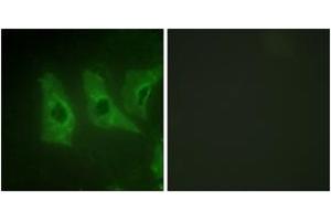 Immunofluorescence analysis of HeLa cells, using CKI-alpha (Ab-321) Antibody. (CSNK1A1 Antikörper  (AA 287-336))