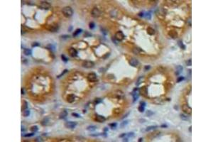 Used in DAB staining on fromalin fixed paraffin-embedded kidney tissue (CAPN1 Antikörper  (AA 185-356))