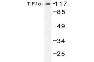Western blot (WB) analysis of TIF1alpha antibody in extracts from COLO cells. (TRIM24 Antikörper)