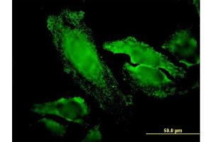 Immunofluorescence of monoclonal antibody to RPS7 on HeLa cell.