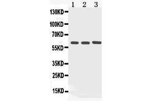 Western blot analysis of Cytokeratin 5 expression in rat kidney extract ( Lane 1), COLO320 whole cell lysates ( Lane 2) and HELA whole cell lysates ( Lane 3).
