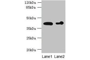 Western blot All lanes: ASPHD2 antibody at 4 μg/mL Lane 1: Hela whole cell lysate Lane 2: HL60 whole cell lysate Secondary Goat polyclonal to rabbit IgG at 1/10000 dilution Predicted band size: 42 kDa Observed band size: 42 kDa (ASPHD2 Antikörper  (AA 80-369))
