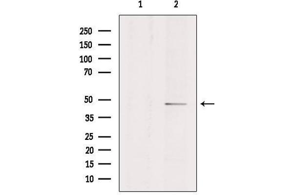 Endothelin-1 Receptor Antikörper  (C-Term)