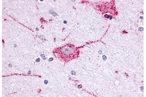 Anti-OPRM1 / Mu Opioid Receptor antibody  ABIN1049170 IHC staining of human brain, neuron. (Mu Opioid Receptor 1 Antikörper  (Extracellular Domain))