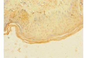 Immunohistochemistry of paraffin-embedded human skin tissue using ABIN7144737 at dilution of 1:100 (ASPHD1 Antikörper  (AA 96-390))