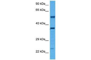 Host:  Rabbit  Target Name:  SMAD1  Sample Tissue:  Mouse Kidney  Antibody Dilution:  1ug/ml (SMAD1 Antikörper  (Middle Region))