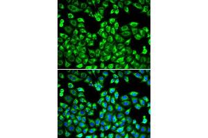Immunofluorescence analysis of MCF-7 cell using PSMC2 antibody. (PSMC2 Antikörper  (AA 1-160))