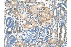 UBE2E2 antibody was used for immunohistochemistry at a concentration of 4-8 ug/ml to stain EpitheliaI cells of renal tubule (arrows) in Human Kidney. (UBE2E2 Antikörper)