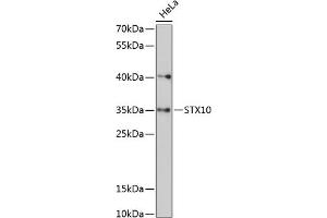 Western blot analysis of extracts of HeLa cells, using STX10 antibody (ABIN6129720, ABIN6148651, ABIN6148652 and ABIN6217958) at 1:3000 dilution. (Syntaxin 10 Antikörper  (AA 76-165))