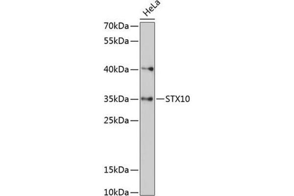 Syntaxin 10 Antikörper  (AA 76-165)