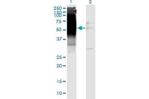 Western Blot analysis of GDF5 expression in transfected 293T cell line by GDF5 monoclonal antibody (M06), clone 1F4. (GDF5 Antikörper  (AA 28-127))