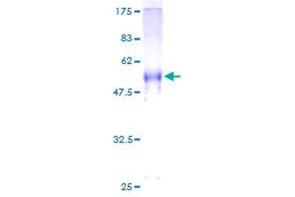 CABP1 Protein (AA 1-304) (GST tag)