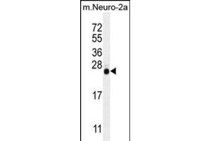 LIN28 Antibody (ABIN655496 and ABIN2845014) western blot analysis in mouse Neuro-2a cell line lysates (35 μg/lane). (LIN28A Antikörper)