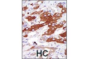 Immunohistochemistry (Paraffin-embedded Sections) (IHC (p)) image for anti-serum/glucocorticoid Regulated Kinase Family, Member 3 (SGK3) (AA 1-30), (N-Term) antibody (ABIN392462)
