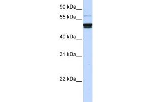 WB Suggested Anti-ZNF93 Antibody Titration:  0. (ZNF93 Antikörper  (N-Term))