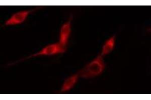 ABIN6274148 staining HeLa cells by IF/ICC. (TK1 Antikörper  (N-Term))