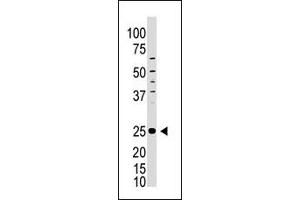 Image no. 1 for anti-Inducible T-Cell Co-Stimulator (ICOS) (C-Term) antibody (ABIN358624) (ICOS Antikörper  (C-Term))