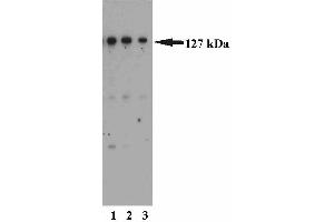 Western blot analysis of MSH3 on a HeLa cell lysate (Human cervical epitheloid carcinoma, ATCC CCL-2). (MSH3 Antikörper  (AA 136-349))