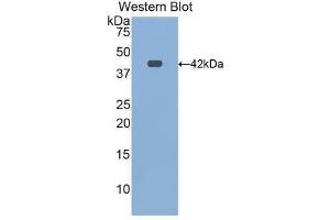 Western Blotting (WB) image for anti-Transferrin Receptor 2 (TFR2) (AA 4-87) antibody (ABIN1172689) (Transferrin Receptor 2 Antikörper  (AA 4-87))