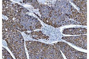 IHC analysis of ALDH1B1 using anti-ALDH1B1 antibody (ABIN4886450).