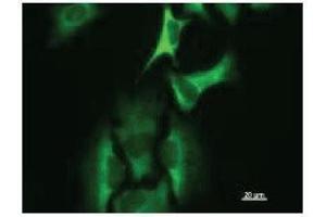 Immunostaining analysis in HeLa cells. (HARS1/Jo-1 Antikörper)