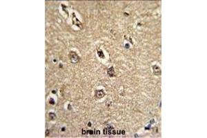 Immunohistochemistry (Paraffin-embedded Sections) (IHC (p)) image for anti-Beclin 1, Autophagy Related (BECN1) antibody (ABIN658976)