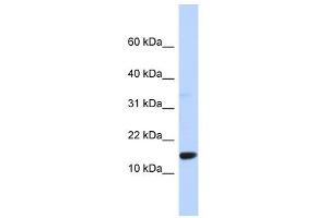 TPD52L3 antibody used at 1 ug/ml to detect target protein. (TPD52L3 Antikörper  (Middle Region))