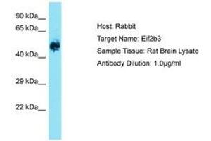 Image no. 1 for anti-Eukaryotic Translation Initiation Factor 2B, Subunit 3 Gamma, 58kDa (EIF2B3) (AA 121-170) antibody (ABIN6750525) (EIF2B3 Antikörper  (AA 121-170))