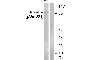 Immunohistochemistry analysis of paraffin-embedded human placenta tissue using B-Raf (Phospho-Ser602) antibody. (SNRPE Antikörper  (pSer602))