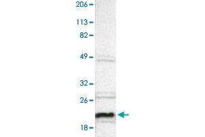 Western blot analysis of Human cell line RT-4 with ALG13 polyclonal antibody .