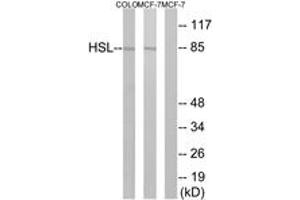 Western Blotting (WB) image for anti-Lipase, Hormone-Sensitive (LIPE) (AA 518-567) antibody (ABIN2888636) (LIPE Antikörper  (AA 518-567))