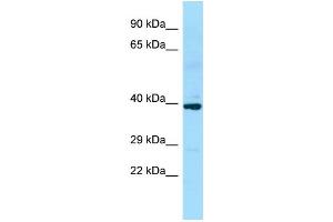 WB Suggested Anti-SLC35D2 Antibody Titration: 1. (Solute Carrier Family 35 (UDP-GlcNAc/UDP-Glucose Transporter), Member D2 (SLC35D2) (C-Term) Antikörper)