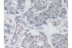 Immunohistochemistry (IHC) image for anti-Glutathione Peroxidase 3 (Plasma) (GPX3) (AA 21-72) antibody (ABIN7435298)