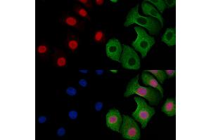 ABIN6257869 and ABIN6273599 staining Hela cells by IF/ICC. (ESRP2 Antikörper  (N-Term))