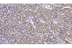 Detection of LY96 in Mouse Kidney Tissue using Polyclonal Antibody to Lymphocyte Antigen 96 (LY96) (LY96 Antikörper  (AA 16-160))