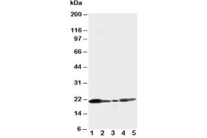 Western blot testing of Caveolin-1 antibody and Lane 1:  U87