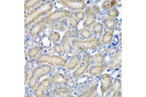 Immunohistochemistry of paraffin-embedded rat kidney using PDCD6 antibody at dilution of 1:200 (40x lens). (PDCD6 Antikörper)