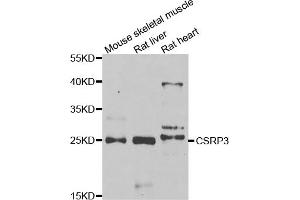 Western blot analysis of extracts of various cell lines, using CSRP3 antibody. (CSRP3 Antikörper)