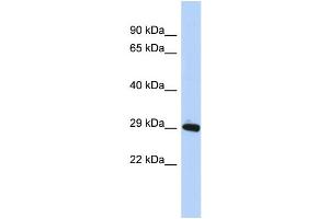 WB Suggested Anti-ZNF524 Antibody Titration:  0. (ZNF524 Antikörper  (N-Term))
