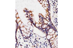 (ABIN6243813 and ABIN6577796) staining CHST12 in Human small intestine tissue sections by Immunohistochemistry (IHC-P - paraformaldehyde-fixed, paraffin-embedded sections). (CHST12 Antikörper  (N-Term))
