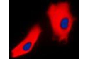 Immunofluorescent analysis of Gamma-catenin staining in A431 cells. (JUP Antikörper  (C-Term))